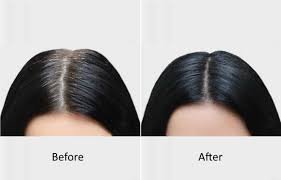 Vitamines pour cheveux blancs